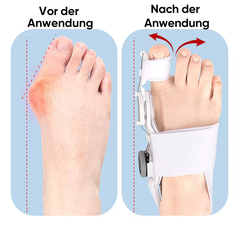 Verbesserter Ballenzehen-Korrektor