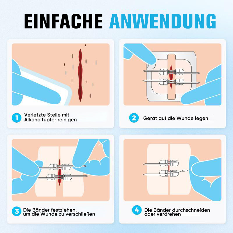 Wundverschlussstreifen ohne Nähen (2 Riemen x 2 Stück/Karton)