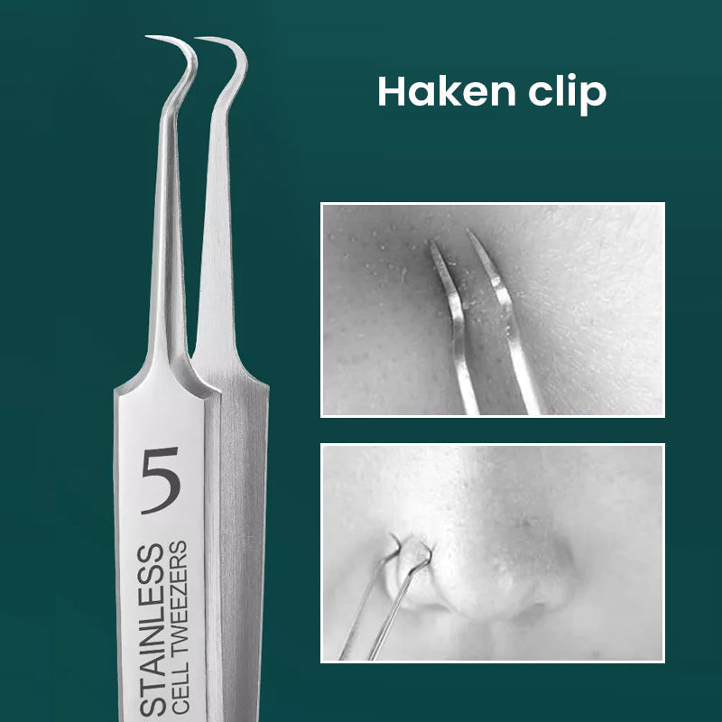 Gluschwein - Professioneller Hochpräziser Clip zum Entfernen von Mitessern C