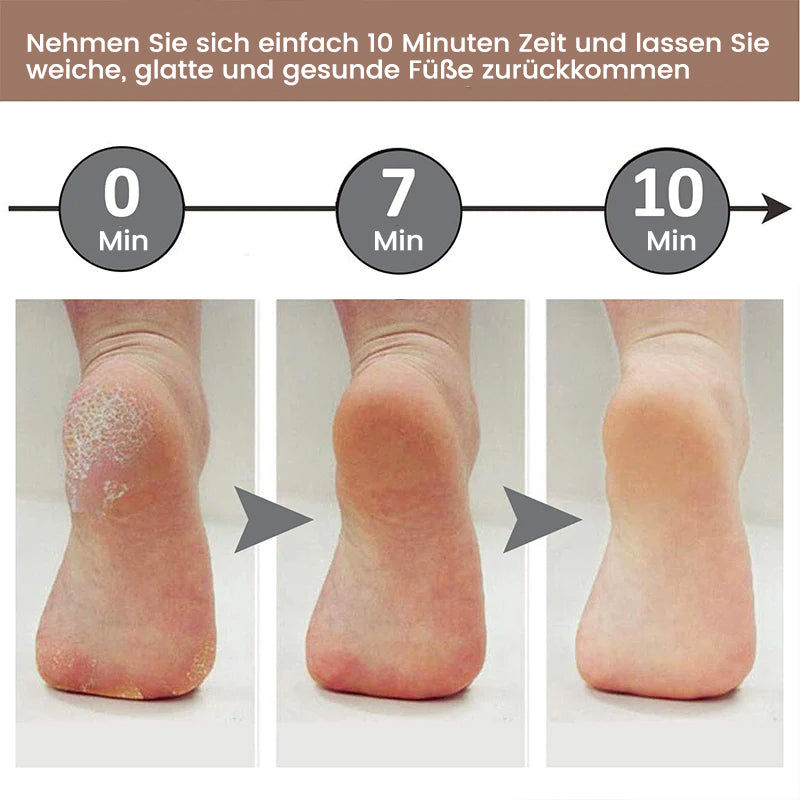 Gluschwein - Elektrischer Fußschleifer