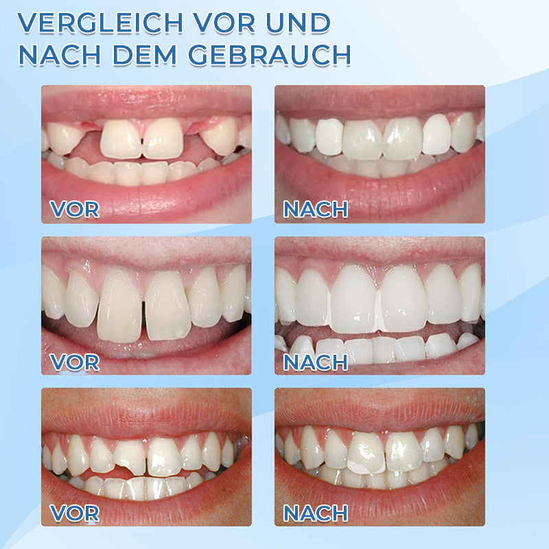 Gluschwein - Fester Zahnrestauration-Kleber