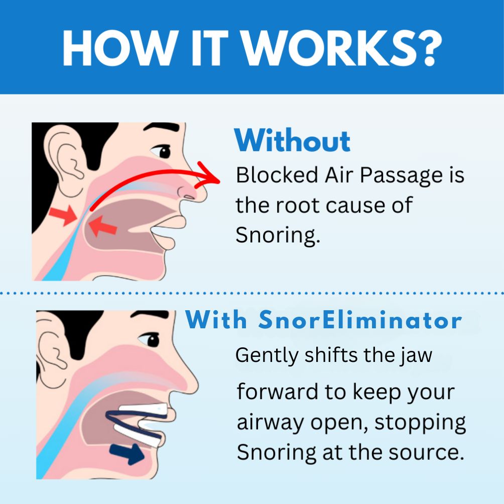 SnorEliminator
