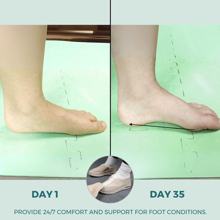 ComfySteps - Des chaussures confortables pour les pieds gonflés