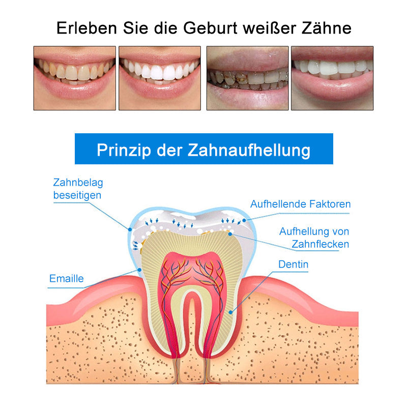 Gluschwein - Zahnreinigungs- und Aufhellungsstift