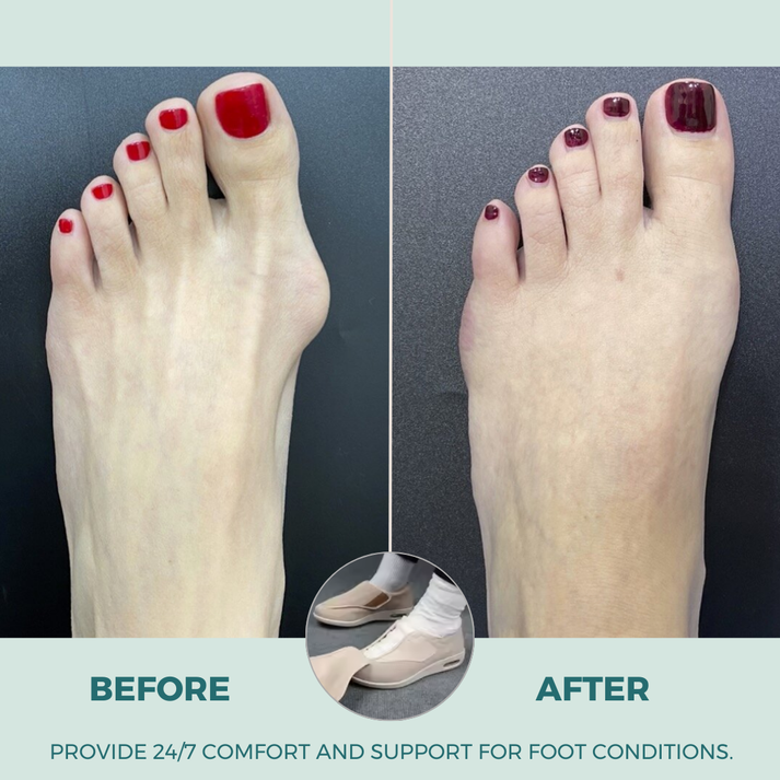 ComfySteps - Des chaussures confortables pour les pieds gonflés