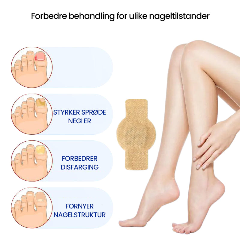 1+1 Gratuit | Nailox | Traitement efficace contre la mycose des ongles