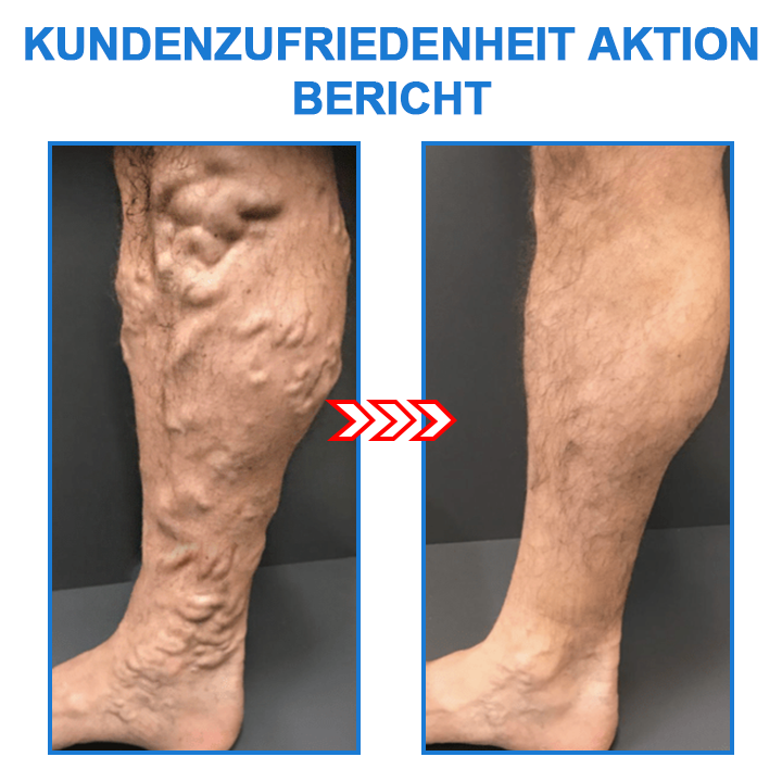 1+2 Gratis | Turmalina™ - Calcetines elásticos moldeadores iónicos