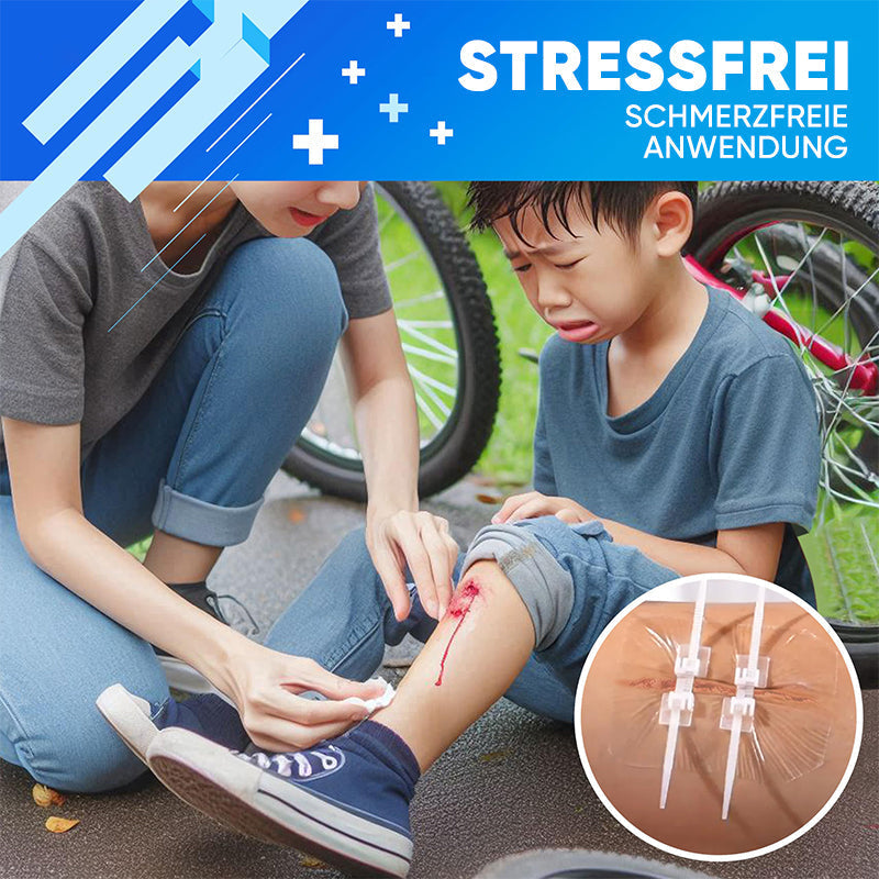 Wundverschlussstreifen ohne Nähen (2 Riemen x 2 Stück/Karton)