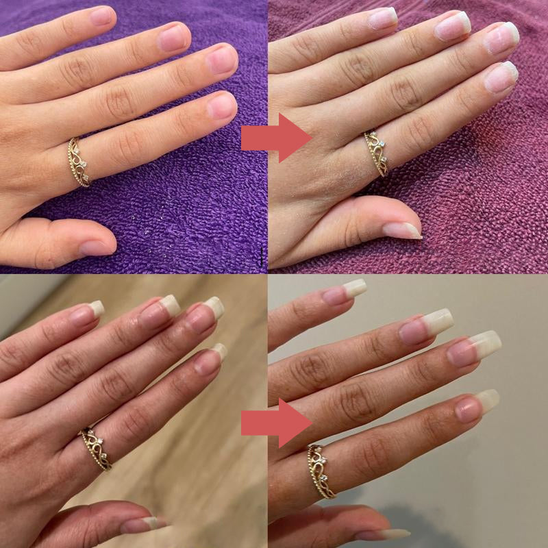 Huiles nourrissantes pour la croissance des ongles