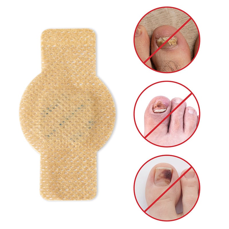 1+1 Gratuit | Nailox | Traitement efficace contre la mycose des ongles