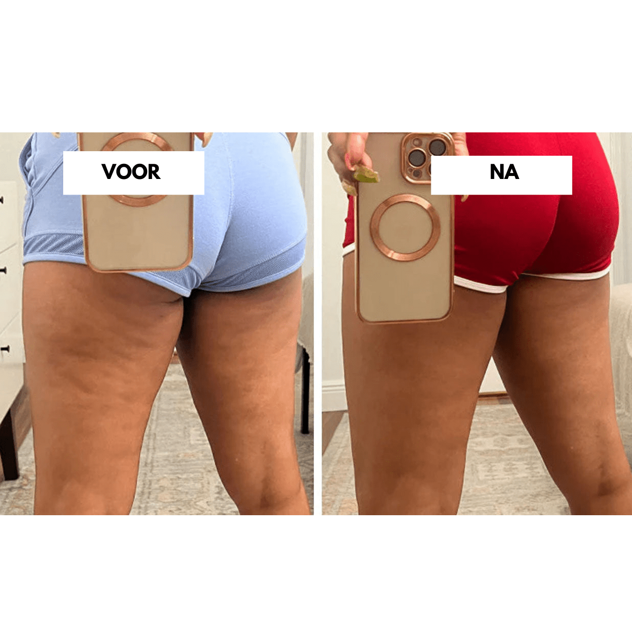 Appareil anti-cellulite CelluCare