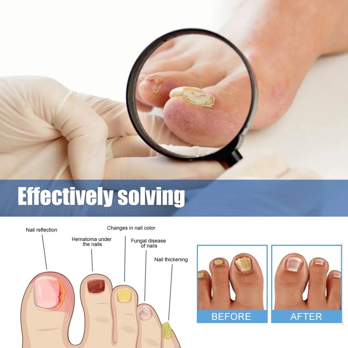 Nail Patches -  Pflaster zur Behandlung von Nagelpilz [60 Stück]