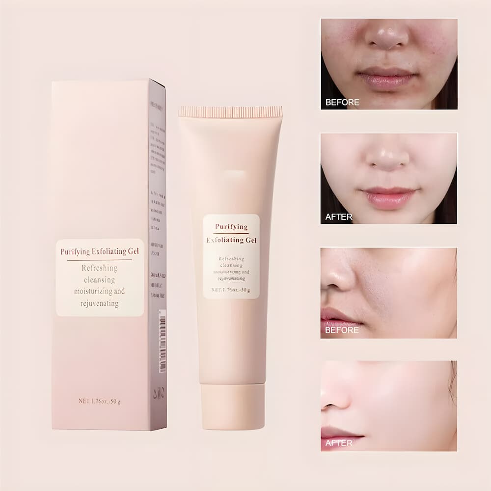 ClearSkin – Peeling-Gel – Endlich Linderung, die wirkt!