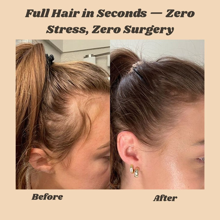 HairCover - Füllt dünner werdendes Haar sofort für einen vollen, natürlichen Look auf [1+1 GRATIS]