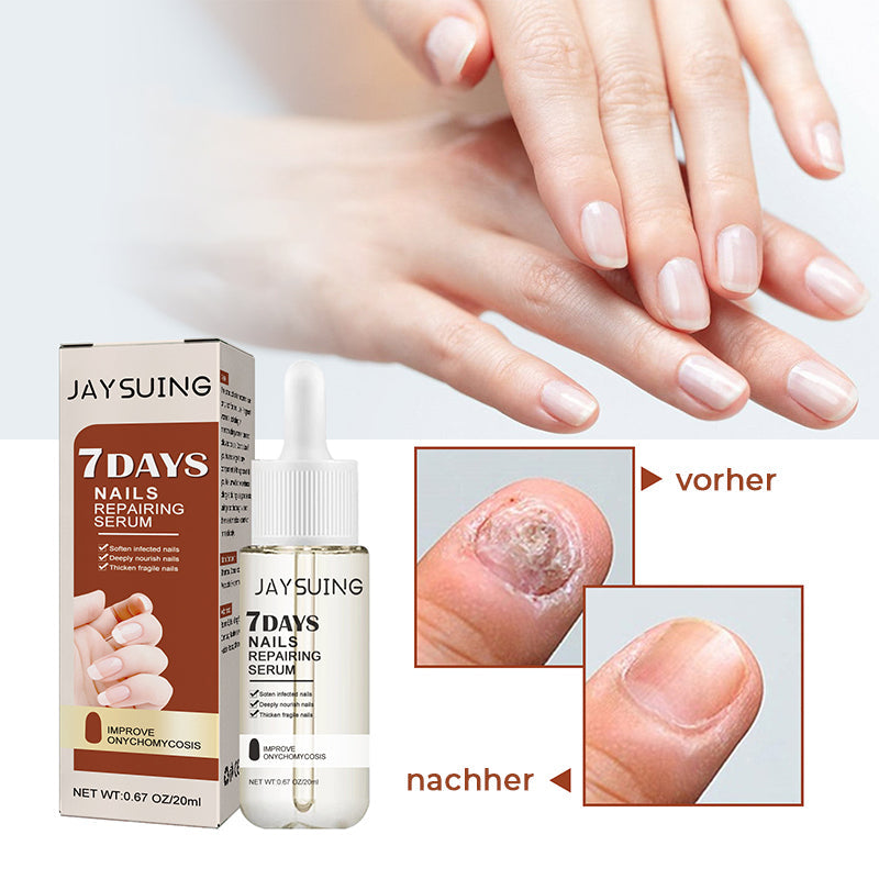 Gluschwein - 7 Tage Nagelwachstums- und Stärkungsserum