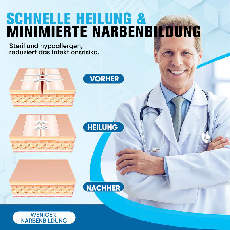 Wundverschlussstreifen ohne Nähen (2 Riemen x 2 Stück/Karton)