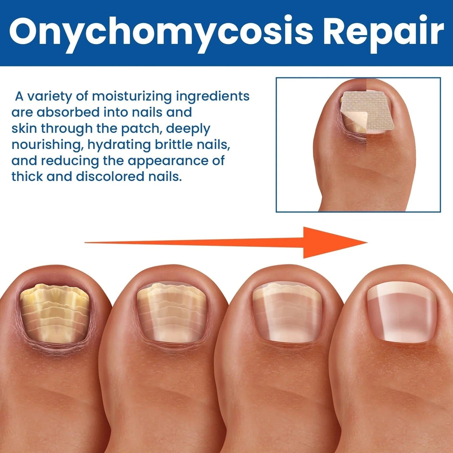 Nail Patches -  Pflaster zur Behandlung von Nagelpilz [60 Stück]