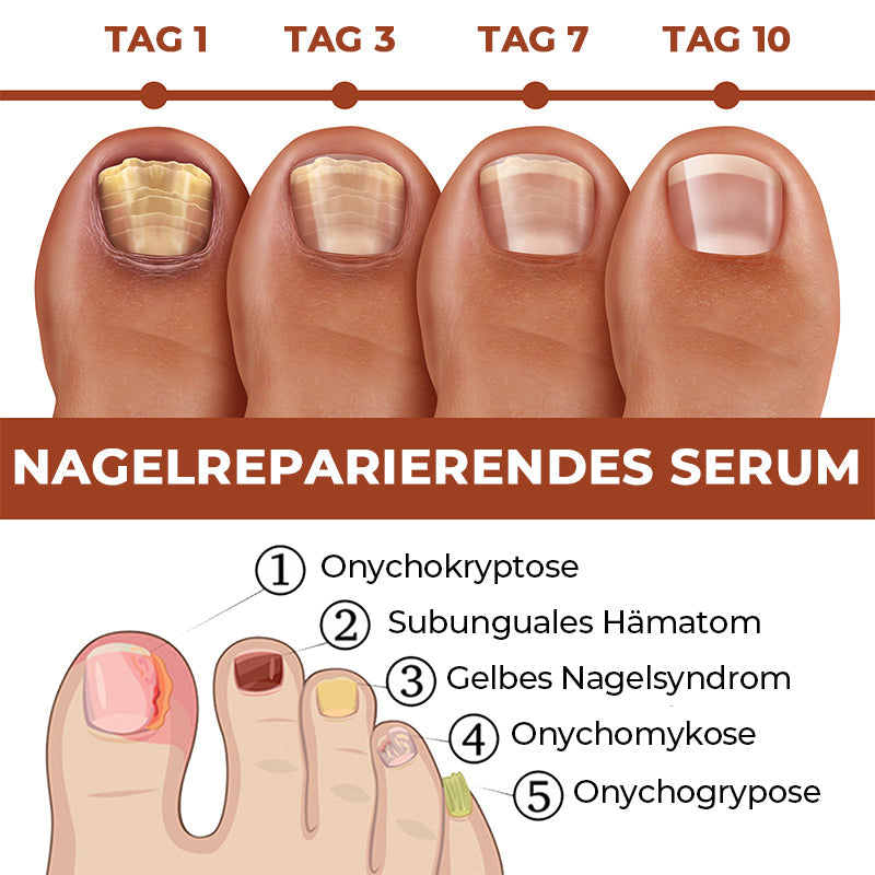 Gluschwein - 7 Tage Nagelwachstums- und Stärkungsserum