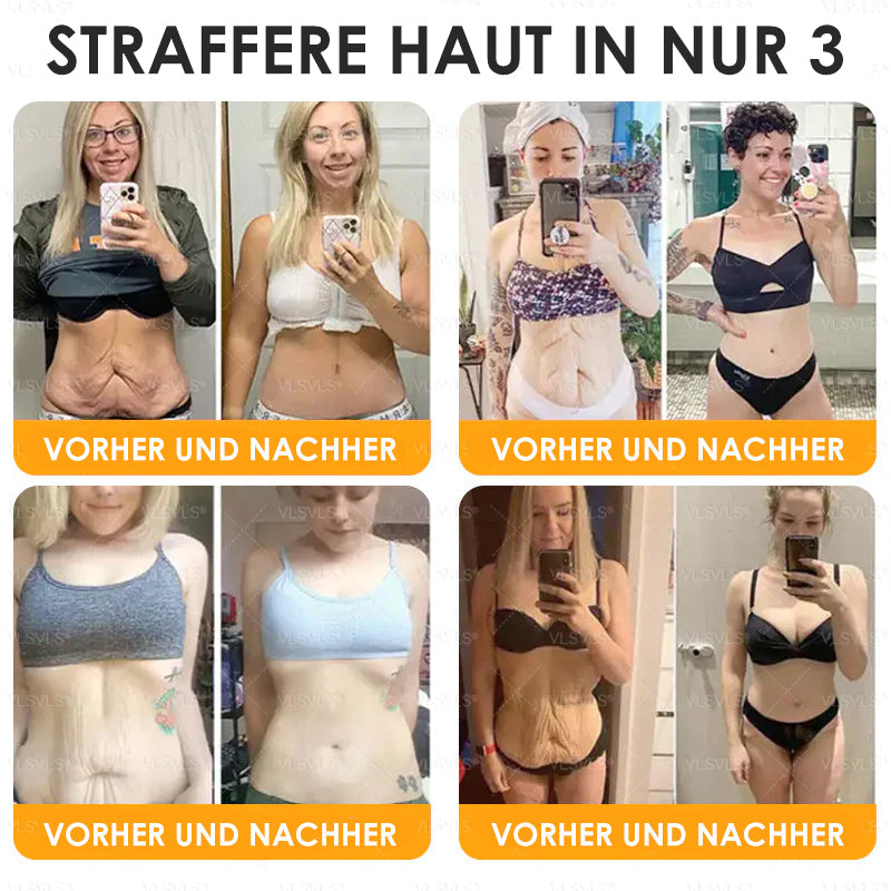 HealSkin – Straffende Anti-Aging-Creme mit Bienengift-Peptiden [1 + 1 Gratis]