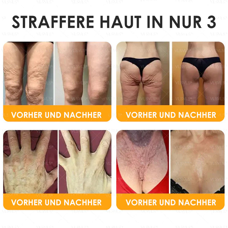 HealSkin – Straffende Anti-Aging-Creme mit Bienengift-Peptiden [1 + 1 Gratis]
