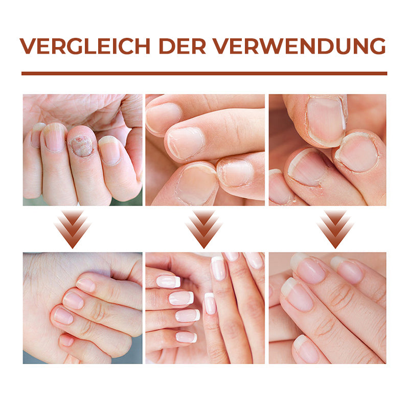 Gluschwein - 7 Tage Nagelwachstums- und Stärkungsserum