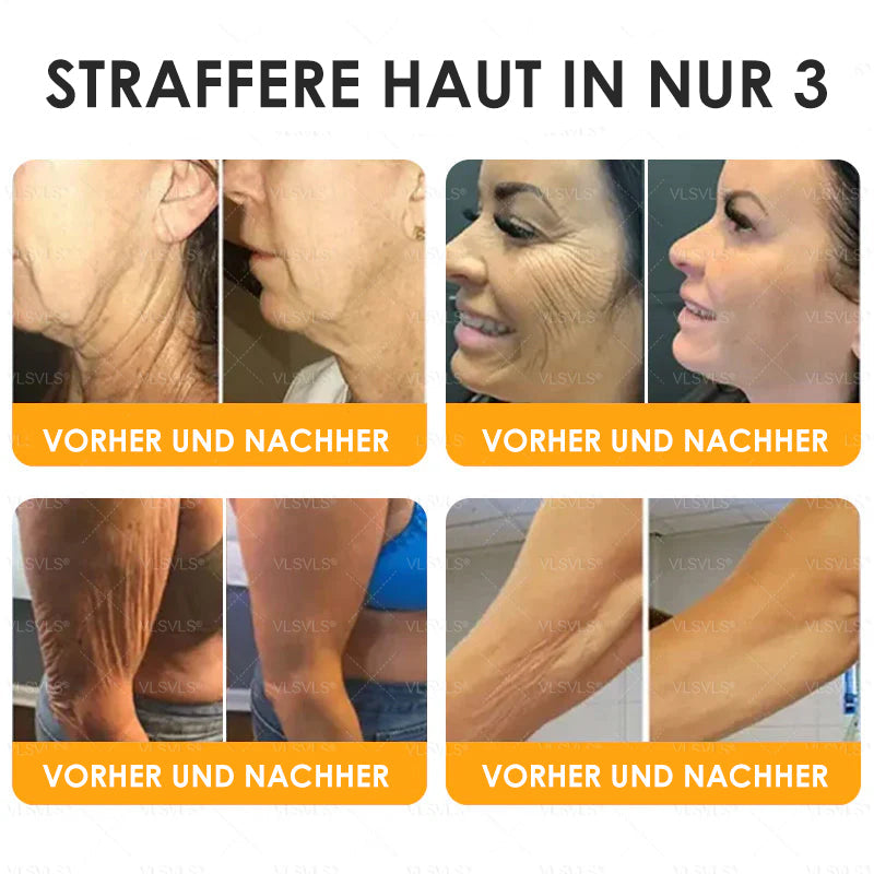 HealSkin – Straffende Anti-Aging-Creme mit Bienengift-Peptiden [1 + 1 Gratis]