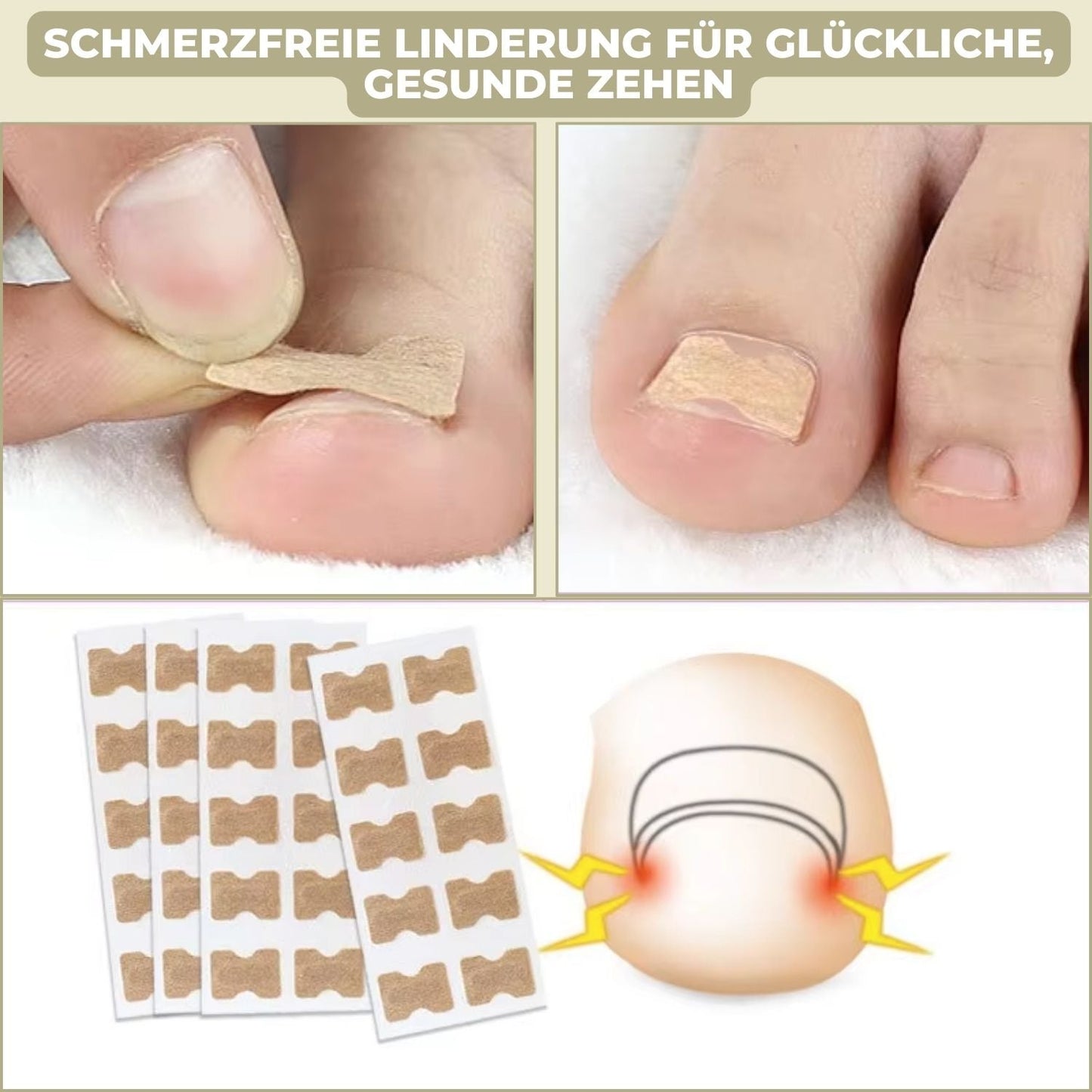 10+10 GRATIS | FixaNail - Sofortige Nagelreparatur