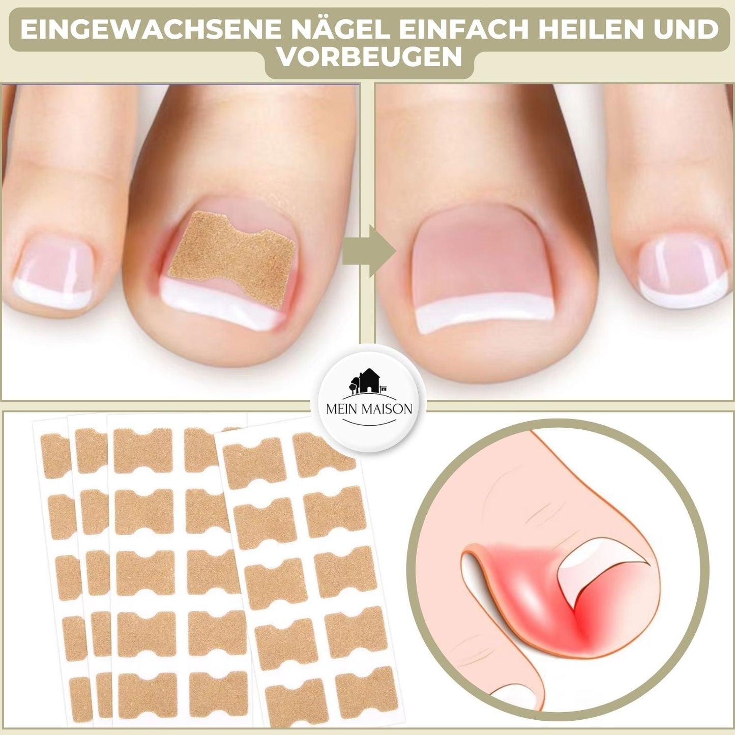 10+10 GRATIS | FixaNail - Sofortige Nagelreparatur