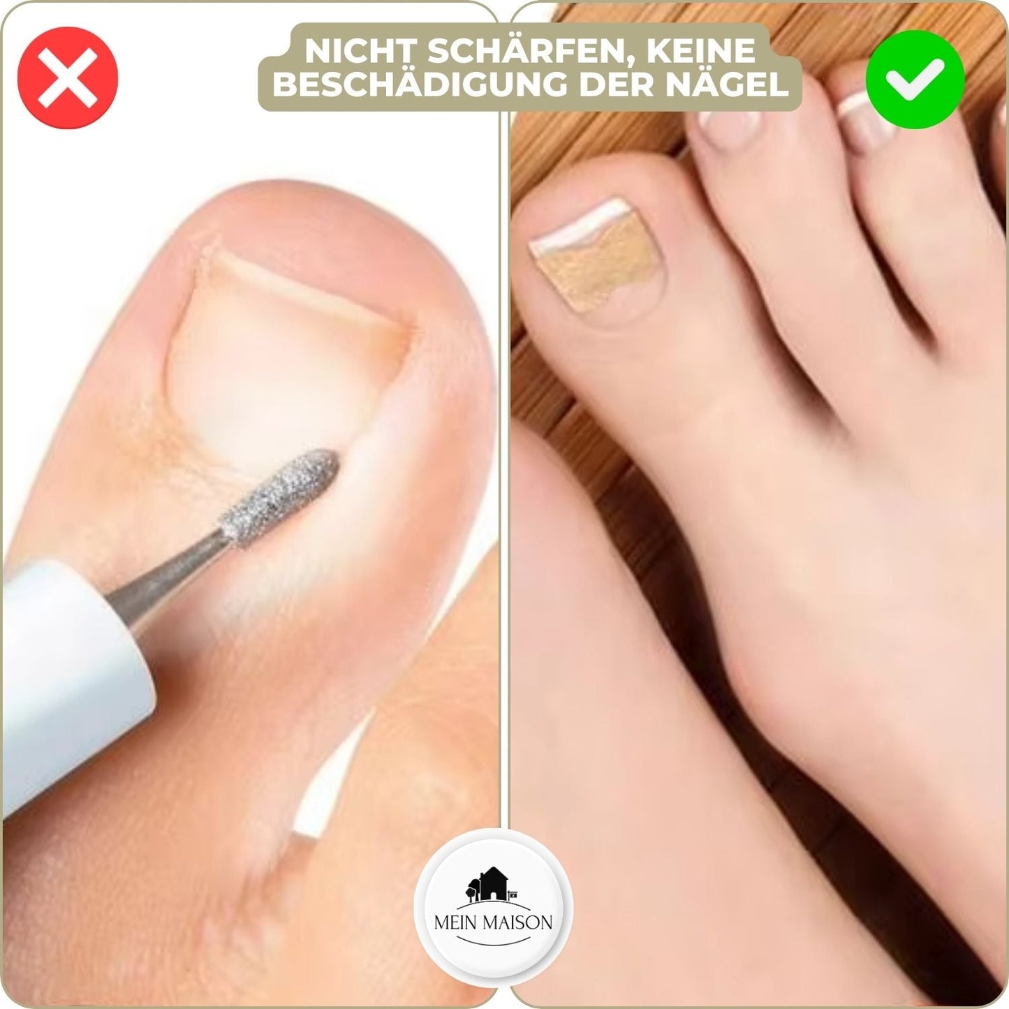10+10 GRATIS | FixaNail - Sofortige Nagelreparatur