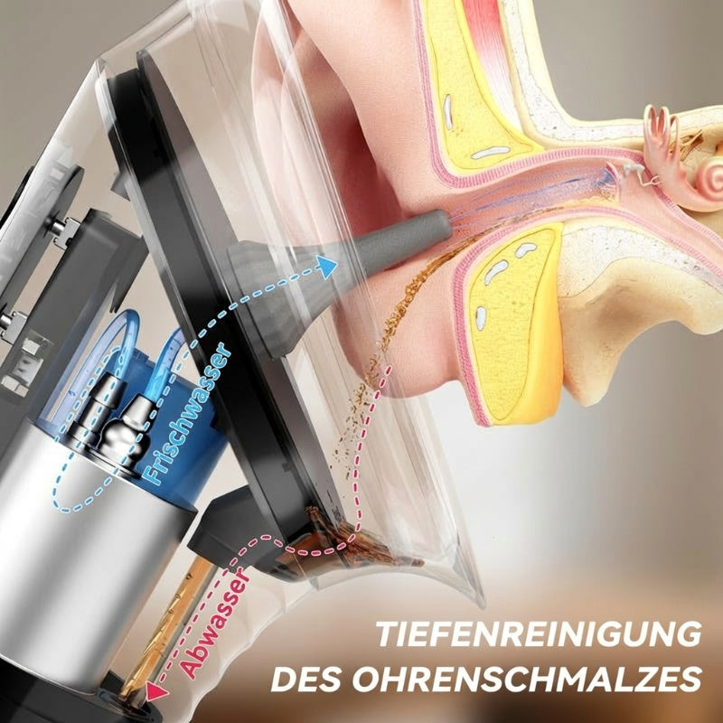 Gluschwein - 🧼 Elektrisches Ohrenspülgerät – 🔋 5-Stufen Einstellbar für Effektive Reinigung des Ohrkanals zu Hause