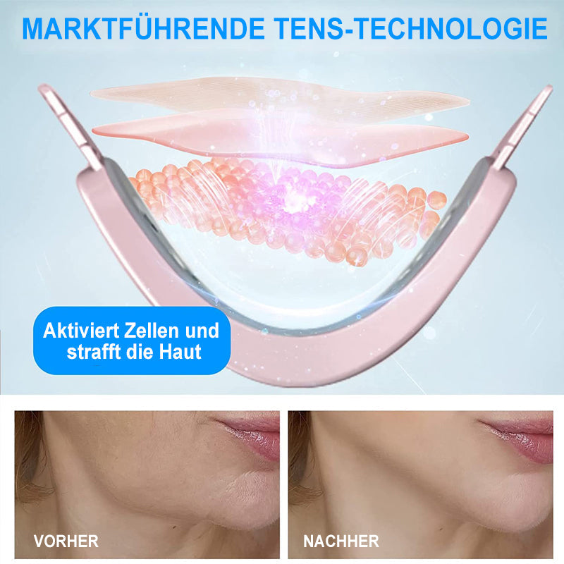 Gluschwein - V-förmiges Facelifting-Instrument