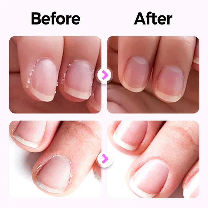 Gluschwein - 🚀Bestseller! 50% OFF – Automatische Nagelfeile für sanfte & sichere Pflege 🎉