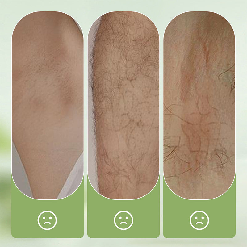 ✨Sanftes und hautfreundliches Haarentfernungsset (Haarentfernungscreme + Rasierer) | Zeitlich begrenztes Angebot 🎁 | Zeitlich begrenztes Angebot 🎁