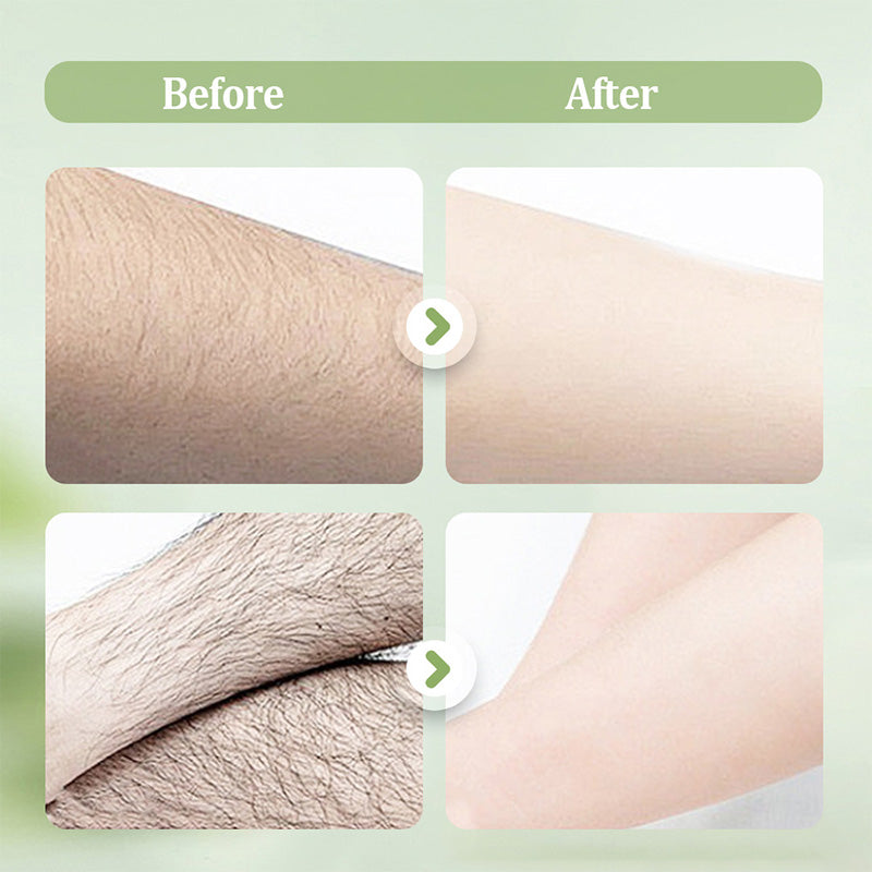 ✨Sanftes und hautfreundliches Haarentfernungsset (Haarentfernungscreme + Rasierer) | Zeitlich begrenztes Angebot 🎁 | Zeitlich begrenztes Angebot 🎁