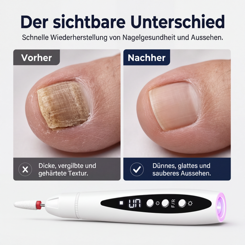 Tragbares 2-in-1 Elektro-Nagelfräser-Set mit UV-Gel-Lampe für Maniküre und Pediküre