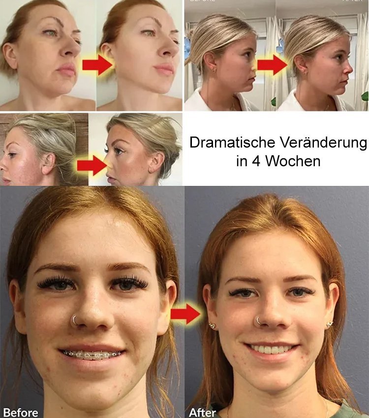 SculptMask - Verjüngende Schlafmaske für das Gesicht